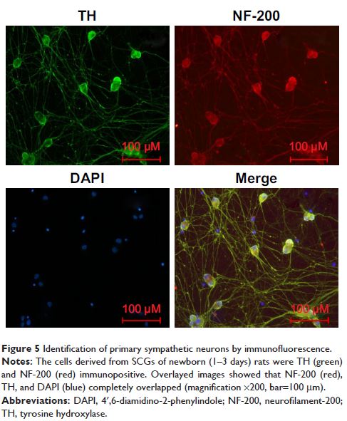 Figure 5 Identification of primary sympathetic neurons by immunofluorescence.