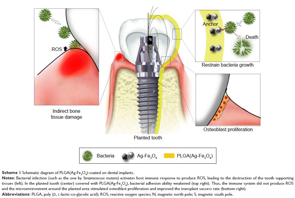 Scheme 1 Schematic diagram of PLGA(Ag-Fe3O4)-coated on dental implants.