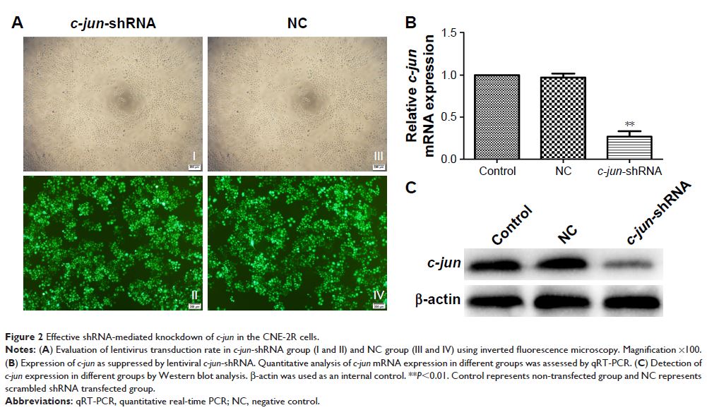 Figure 2 Effective shRNA-mediated knockdown of c-jun in the CNE-2R cells.