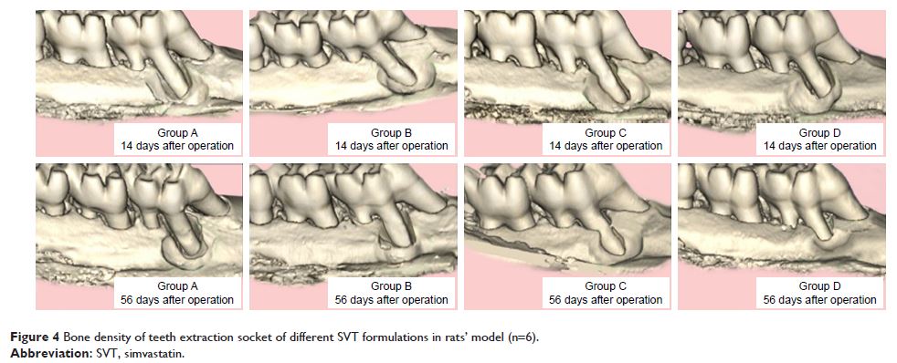 Figure 4 Bone density of teeth extraction socket of different SVT formulations in rats’ model (n=6).
