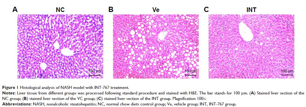 Figure 1 Histological analysis of NASH model with INT-767 treatment.