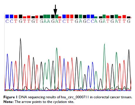 Figure 1 DNA sequencing results of hsa_circ_0000711 in colorectal cancer tissues.