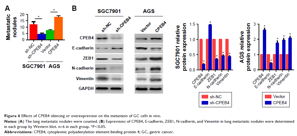 Figure 6 Effects of CPEB4 silencing or overexpression on the metastasis of GC cells in vivo.
