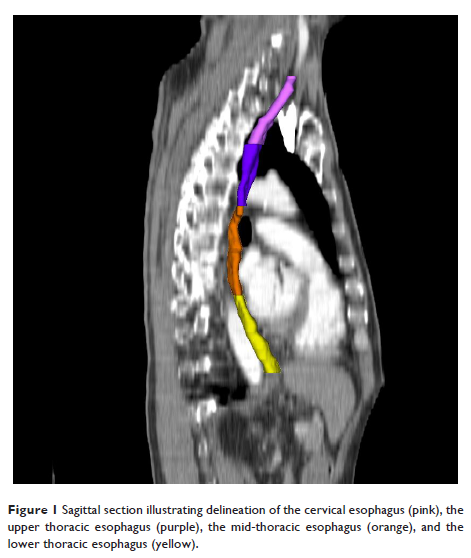 Figure 1 Sagittal section illustrating delineation of the cervical esophagus (pink)...