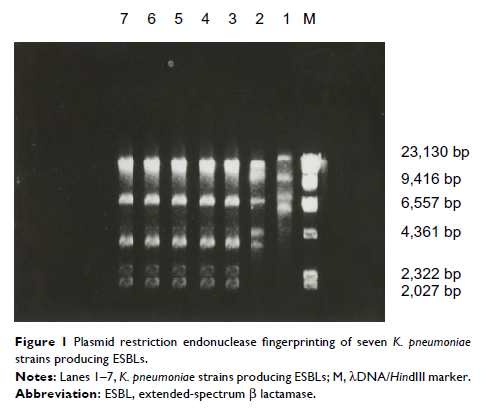 Figure 1 Plasmid restriction endonuclease fingerprinting of seven K. pneumoniae strains producing ESBLs.