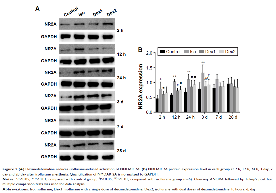Figure 2 (A) Dexmedetomidine reduces isoflurane-induced activation of NMDAR 2A... Figure 2 (A) Dexmedetomidine reduces isoflurane-induced activation of NMDAR 2A...