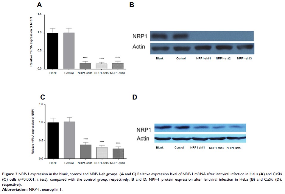 Figure 2 NRP-1 expression in the blank, control and NRP-1-sh groups. (A and C) Relative expression level of...