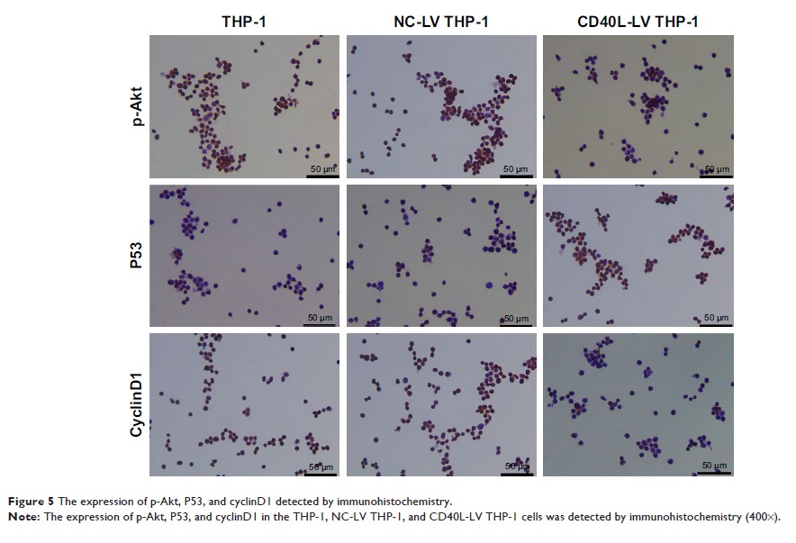 Figure 5 The expression of p-Akt, P53, and cyclinD1 detected by immunohistochemistry.