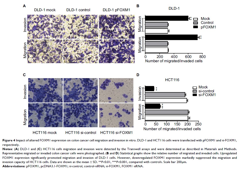 Figure 4 Impact of altered FOXM1 expression on colon cancer cell migration and...