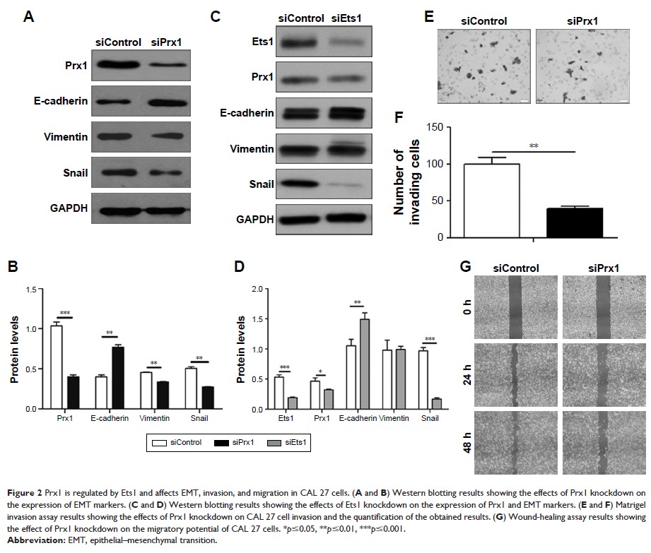 Figure 2 Prx1 is regulated by Ets1 and affects EMT, invasion, and migration in...