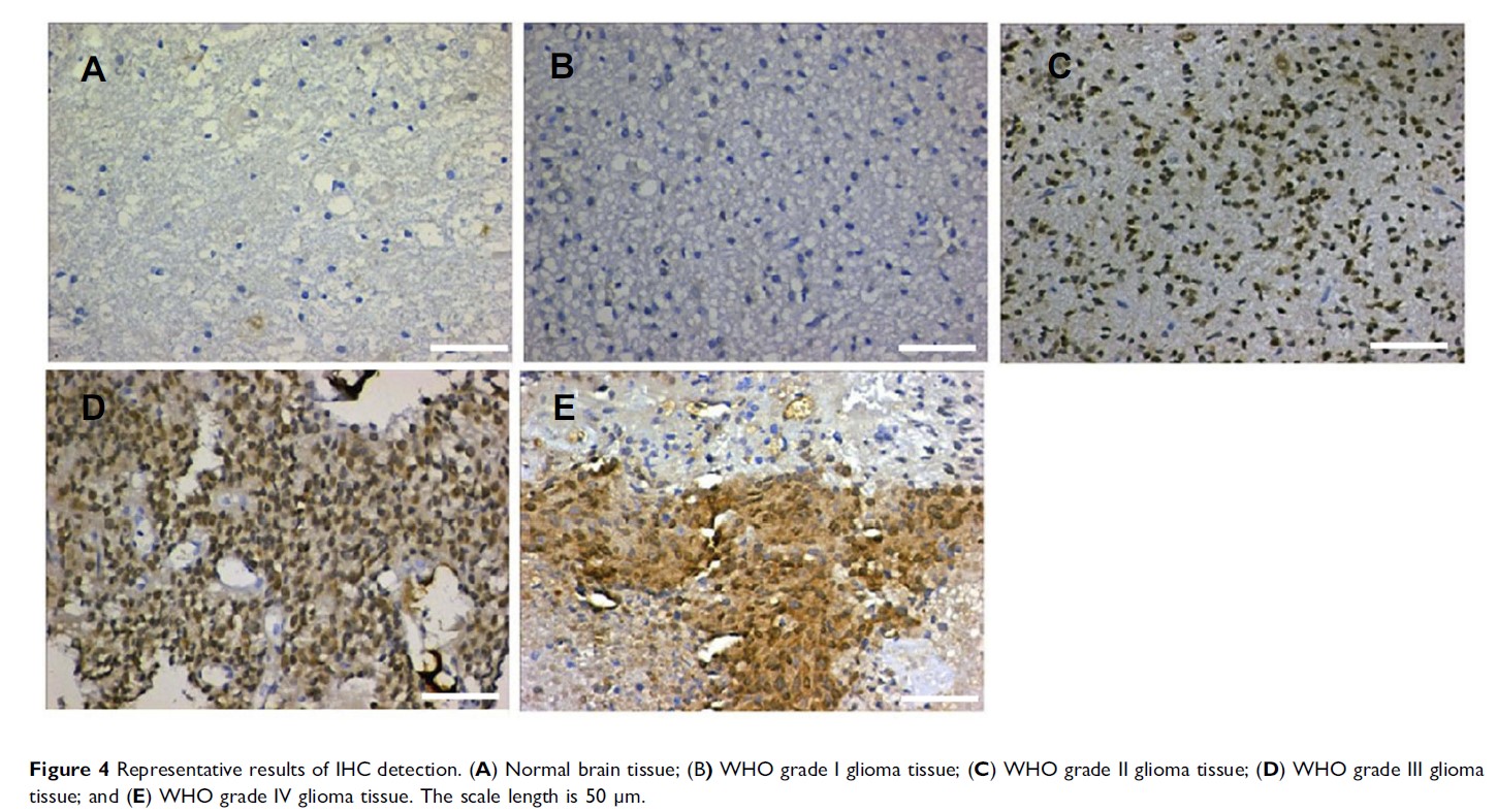 Figure 4 Representative results of IHC detection. (A) Normal brain tissue...