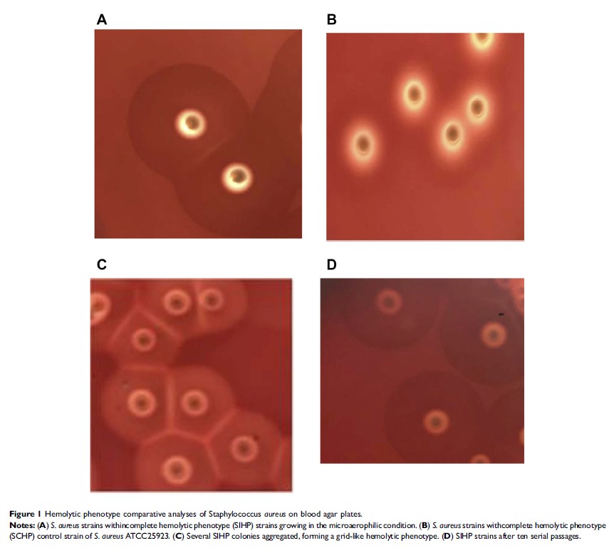 Figure 1 Hemolytic phenotype comparative analyses of Staphylococcus aureus on blood agar plates.