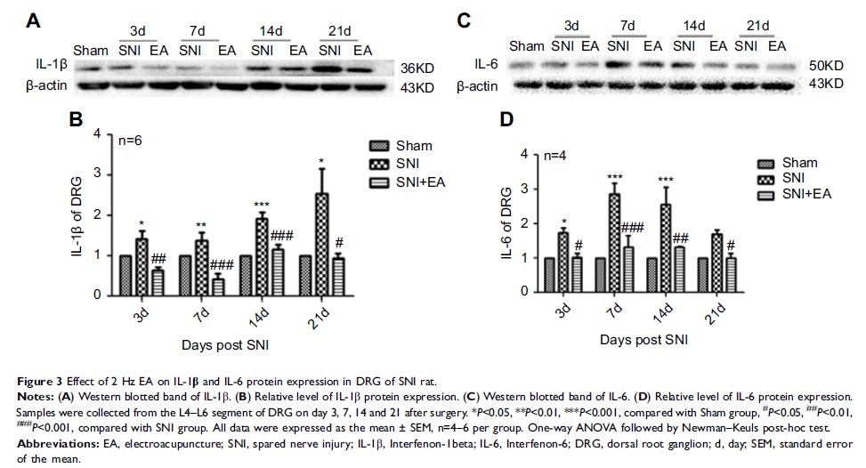 Figure 3 Effect of 2 Hz EA on IL-1β and IL-6 protein expression in DRG of SNI rat.