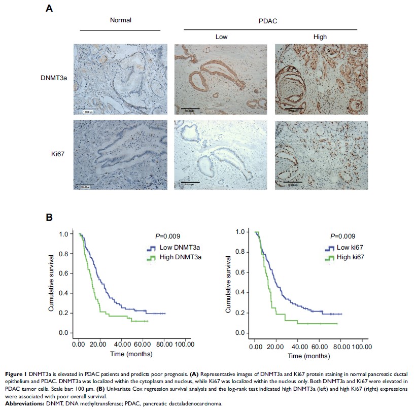 Figure 1 DNMT3a is elevated in PDAC patients and predicts poor prognosis...