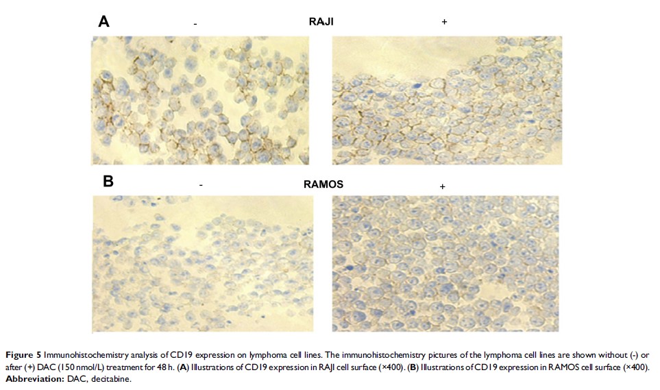 Figure 5 Immunohistochemistry analysis of CD19 expression on lymphoma cell lines...