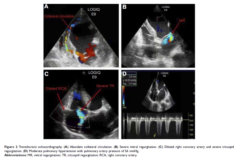Figure 2 Transthoracic echocardiography...