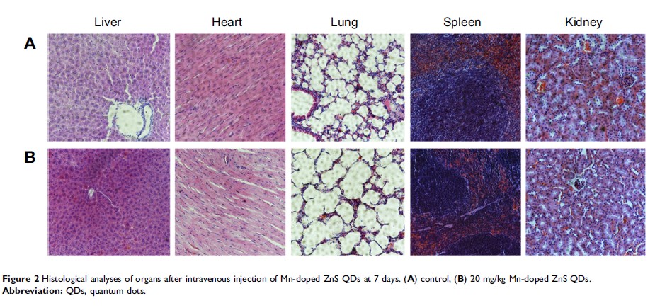 Figure 2 Histological analyses of organs after intravenous injection of...