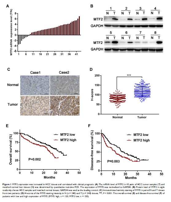 Figure 1 MTF2 expression was increased in HCC tissues and...