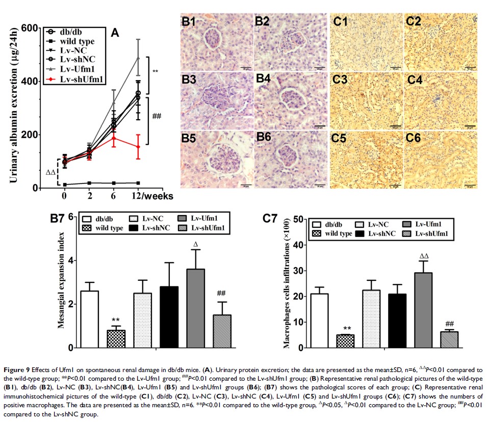 Figure 9 Effects of Ufm1 on spontaneous renal damage in db/db mice...