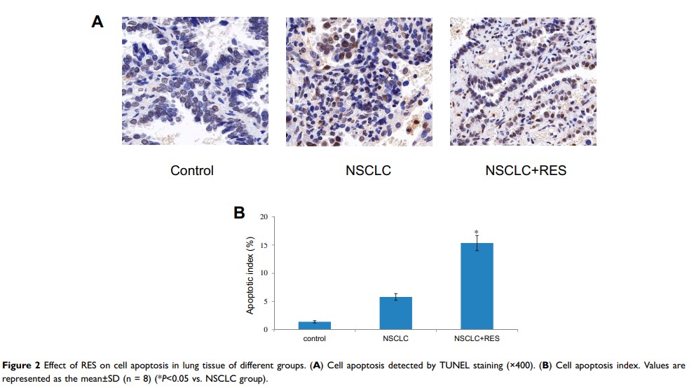 Figure 2 Effect of RES on cell apoptosis in lung tissue of different groups...