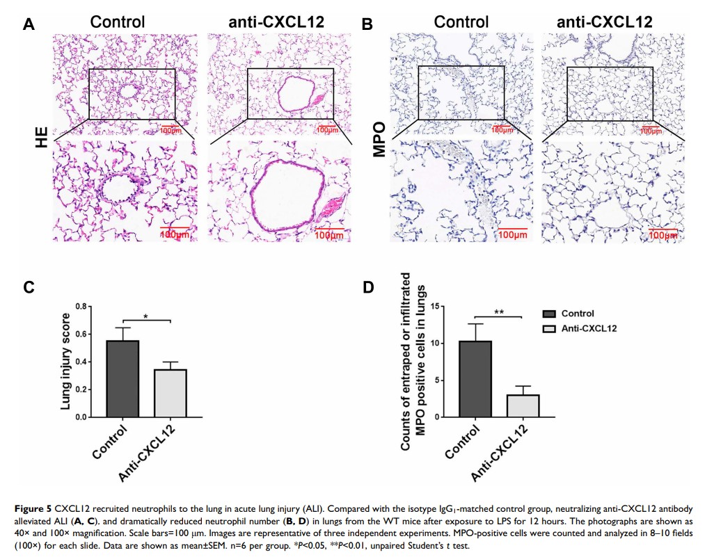 Figure 5 CXCL12 recruited neutrophils to the lung in acute lung injury (ALI)...