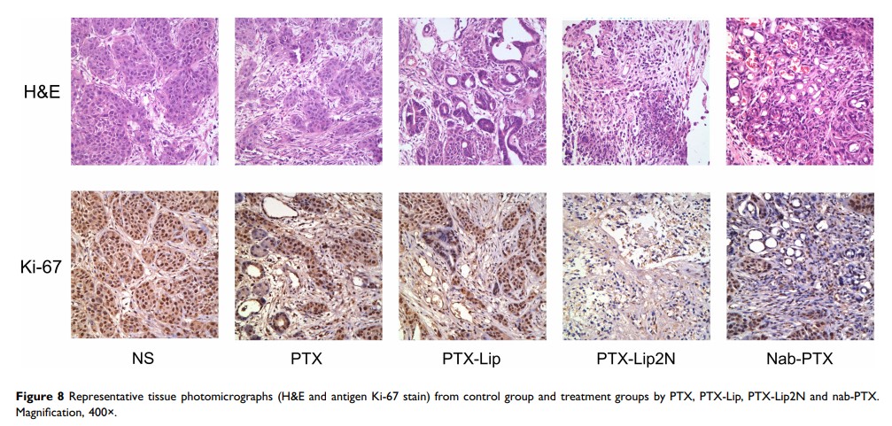 Figure 8 Representative tissue photomicrographs (H&E and antigen Ki-67 stain) from...