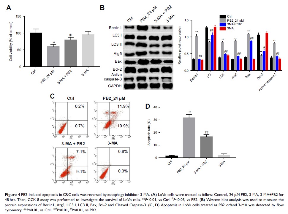 Figure 4 PB2-induced apoptosis in CRC cells was reversed by autophagy inhibitor 3-MA... Figure 4 PB2-induced apoptosis in CRC cells was reversed by autophagy inhibitor 3-MA...