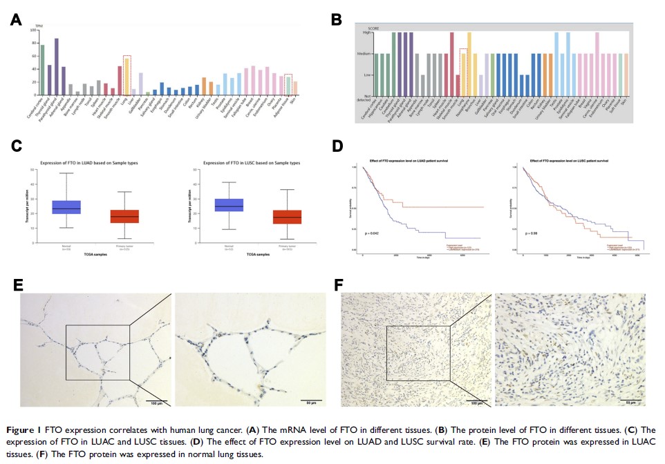 Figure 1 FTO expression correlates with human lung cancer... Figure 1 FTO expression correlates with human lung cancer...